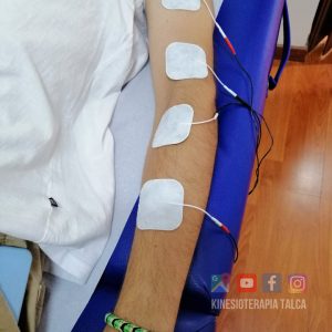 Fisioterapia en Talca