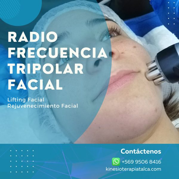 Radiofrecuencia Facial Talca