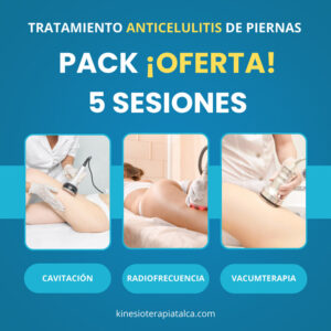 Celulitis clínica Talca