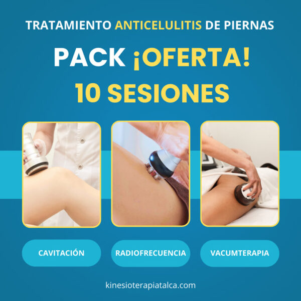 Tratamiento para celulitis en Talca